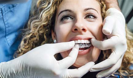 dentist putting Invisalign aligner on patient