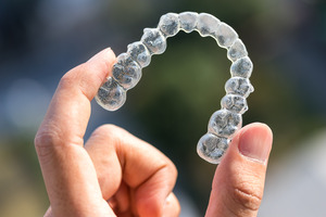 Picture of an Invisalign aligner