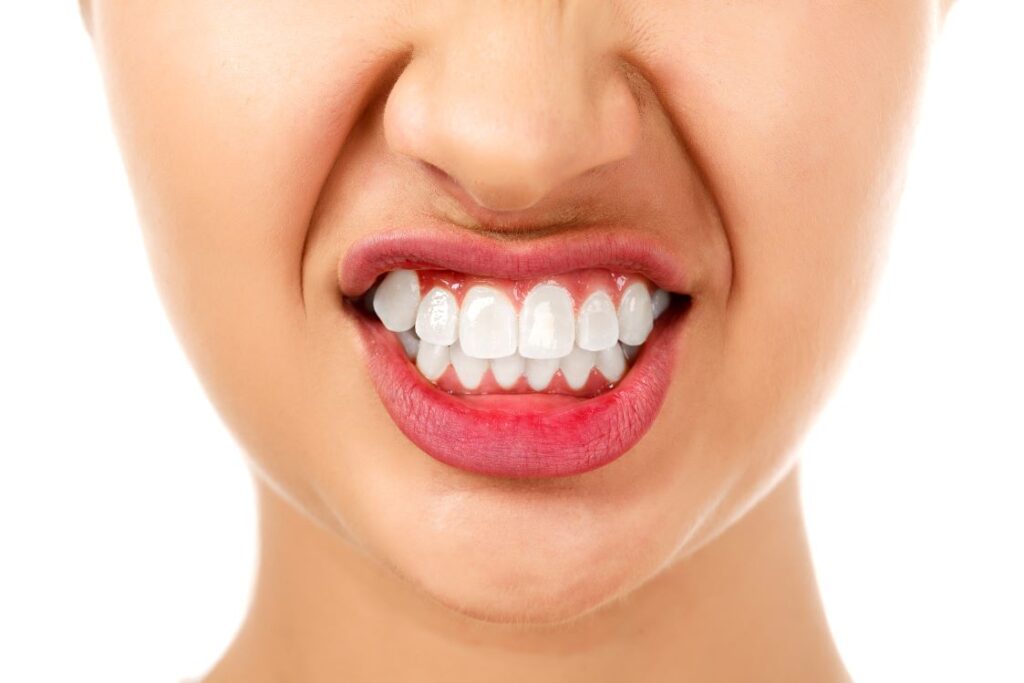 A woman grinding her teeth